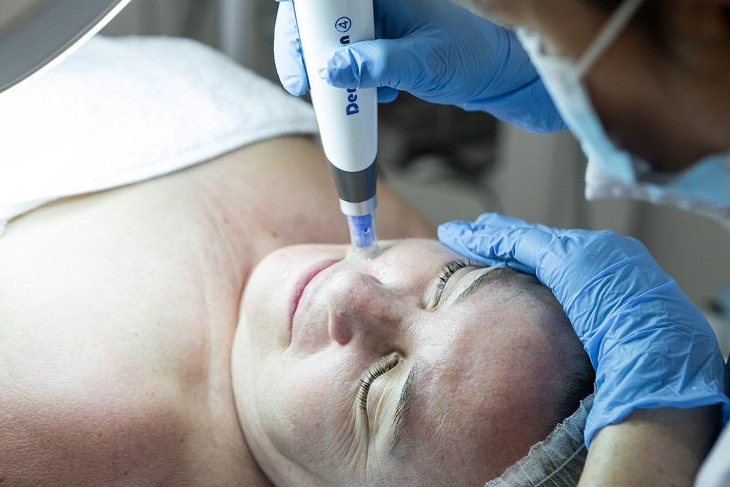 acne-piel-tratamiento acne piel tratamiento sevilla