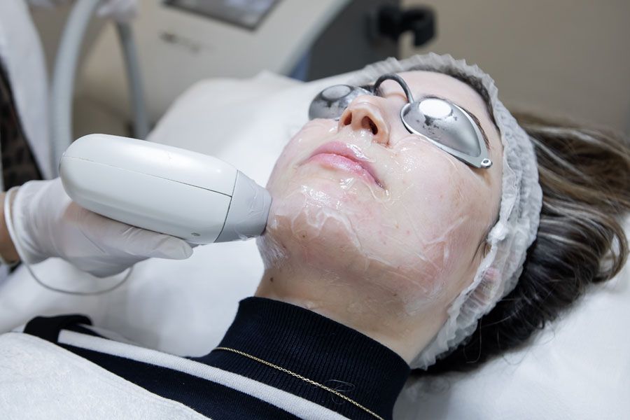 resultados antes depues depilacion laser
