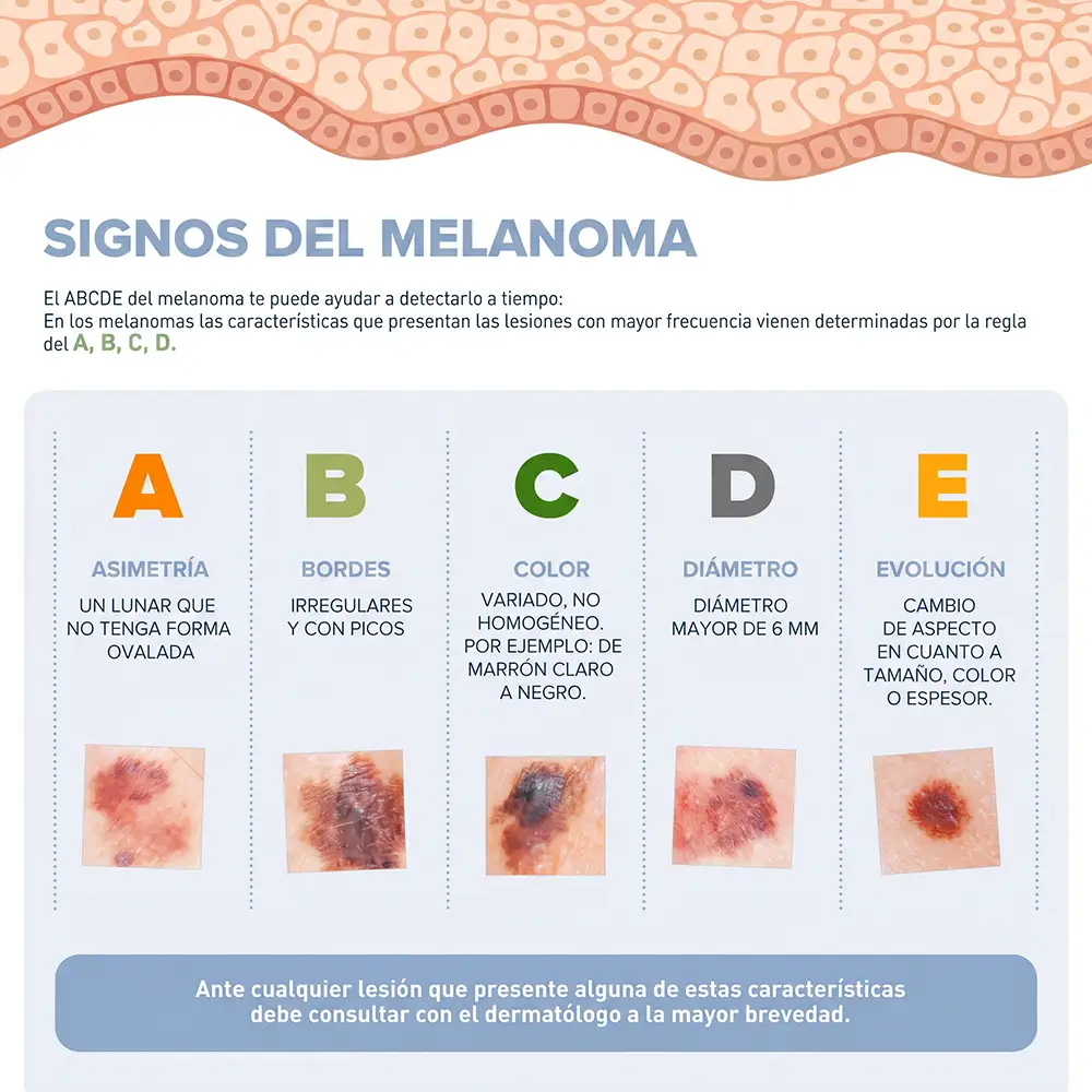 regla abcd manchas