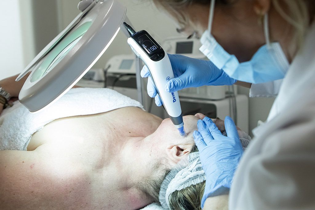 dermapen-sevilla dermapen sevilla