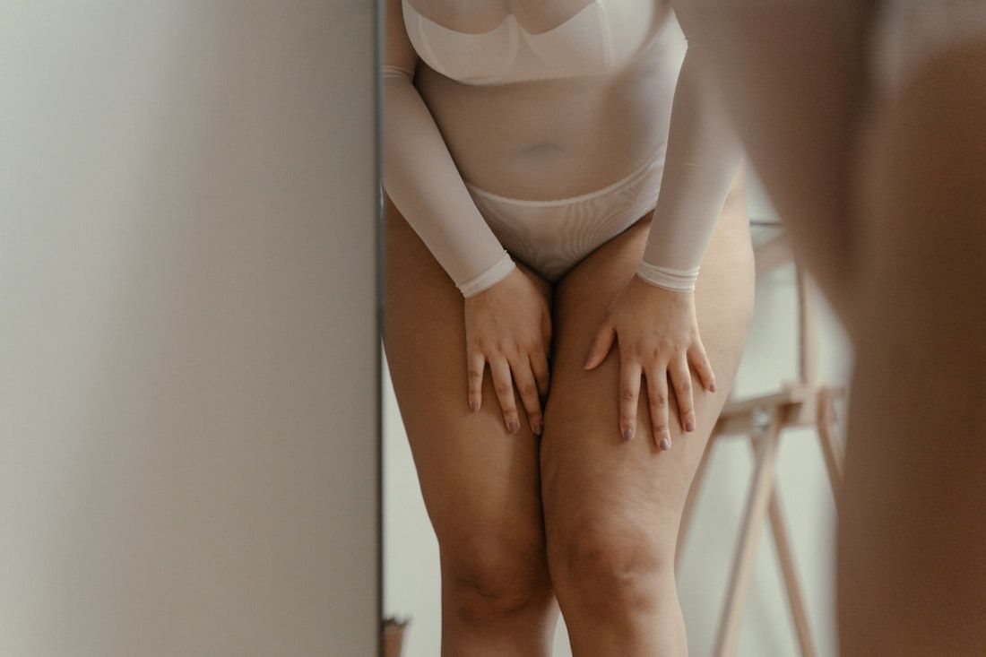 celulitis en las piernas