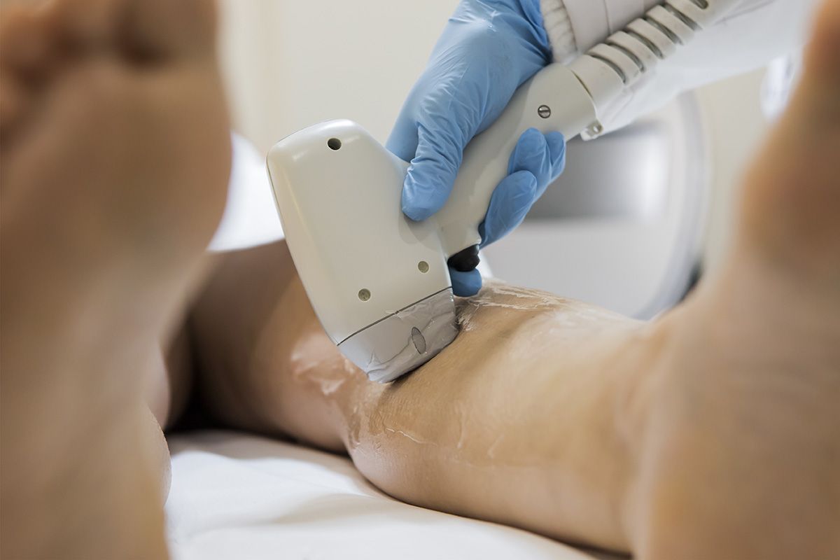 depilacion-laser-piernas-hombres depilacion laser piernas hombres