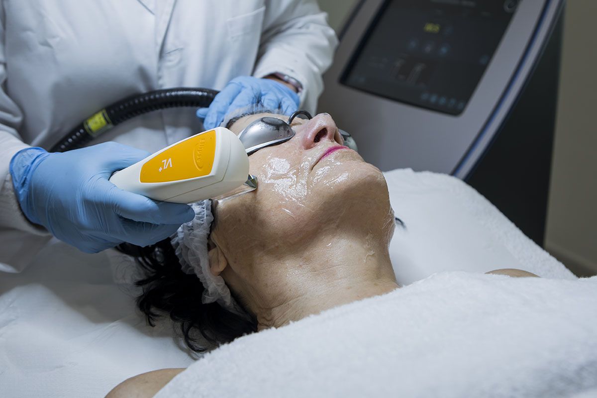 luz-pulsada-ipl-antienvejecimiento luz pulsada ipl antienvejecimiento