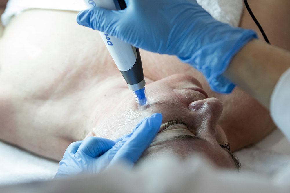 tratamiento eliminar cicatrices sevilla