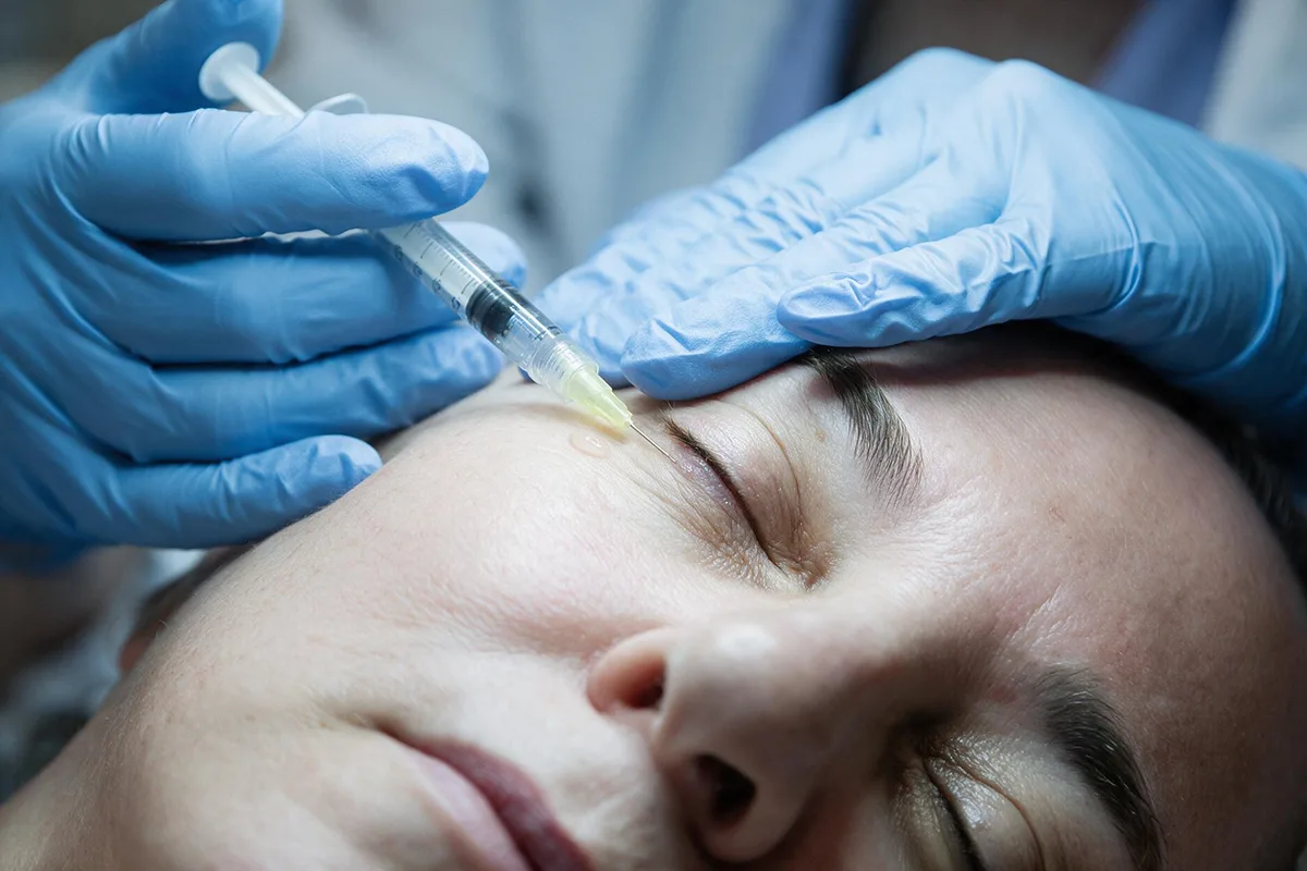 tratamiento ojeras oscuras sevilla
